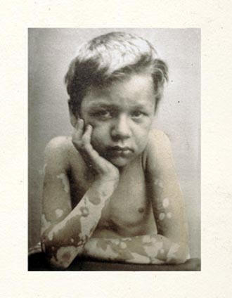 old black and white photos of children. There are more: a lack and