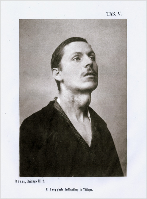 Bruns1888