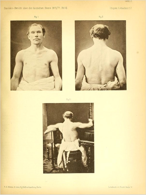 Kriegsministerium1886
