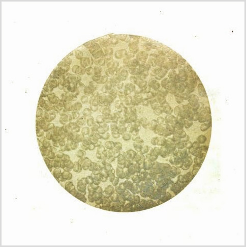 Olley1857