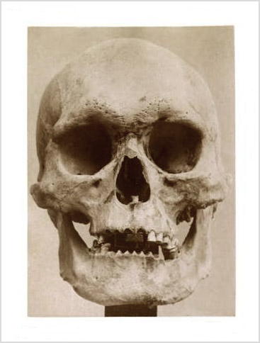 Mantegazza1886