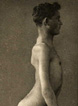 Plate 11 Dystrophia muscularis progressiva juvenalis