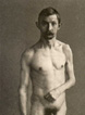 Plate 25 Infantile cerebral palsy