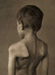 Plate 5 Dystrophia muscularis progressiva infantilis